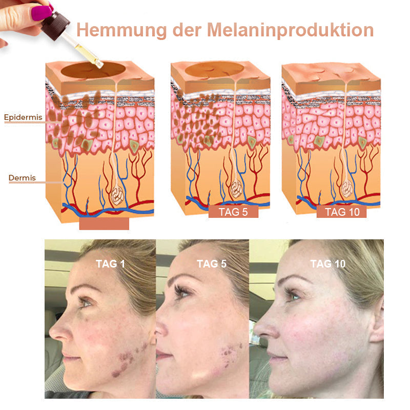đĽKräftiger Entferner dunkler Flecken - JEREMYTIS⢠Vitamin C Spot Brightening Serum