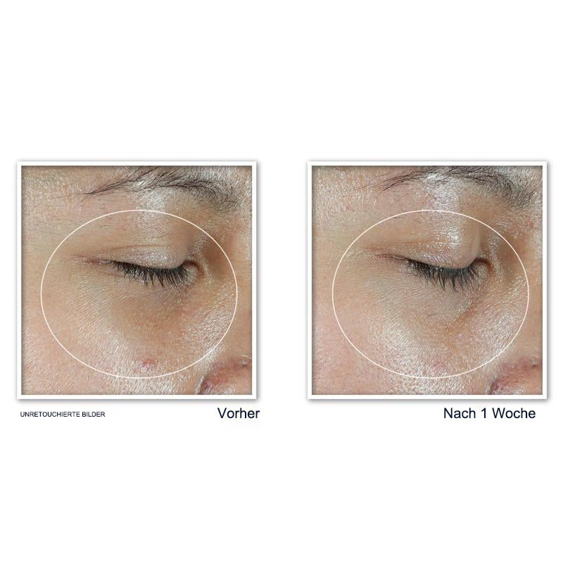 Revive + Glow Augenbalsam mit Vitamin C hellt auf und reduziert Schwellungen