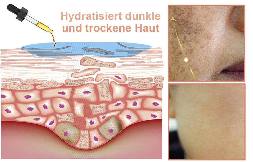 đĽKräftiger Entferner dunkler Flecken - JEREMYTIS⢠Vitamin C Spot Brightening Serum