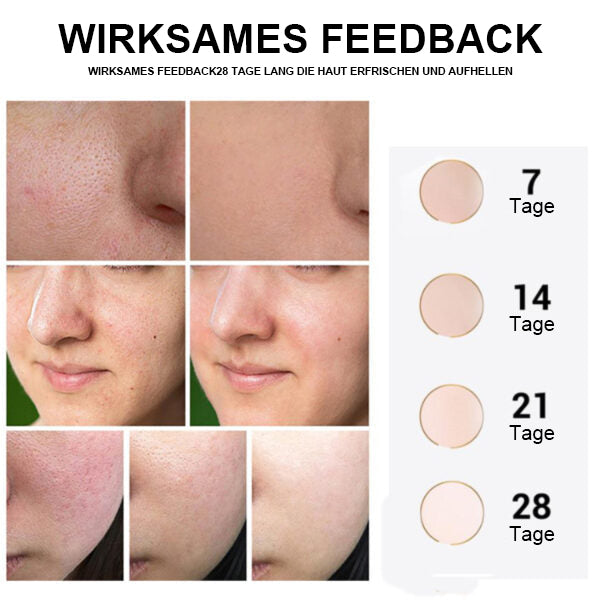 đĽKräftiger Entferner dunkler Flecken - JEREMYTIS⢠Vitamin C Spot Brightening Serum