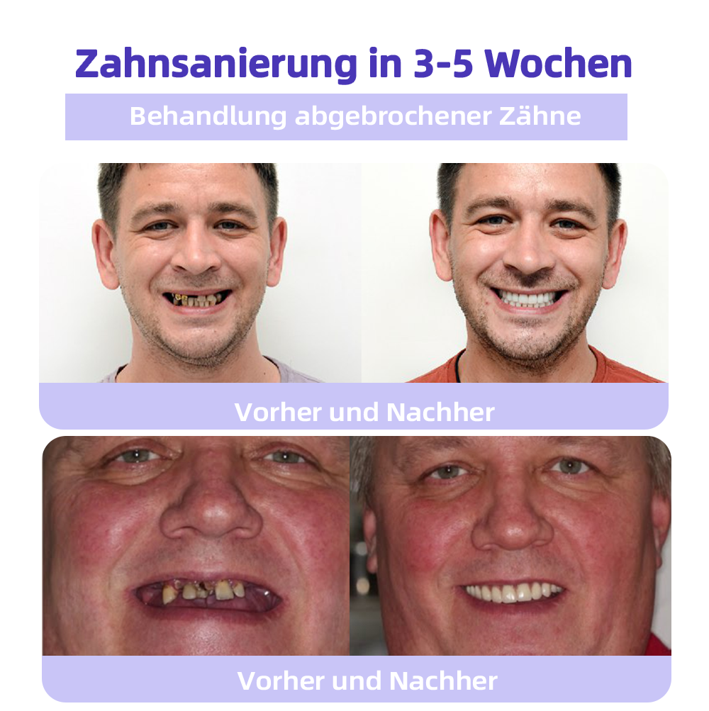 (Ihre Zähne – Unsere Expertise) ODEIUN™ Zahnreparatur-Mineralpuder (Empfohlen von der EDA)