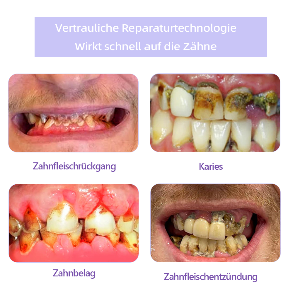 (Ihre Zähne – Unsere Expertise) ODEIUN™ Zahnreparatur-Mineralpuder (Empfohlen von der EDA)