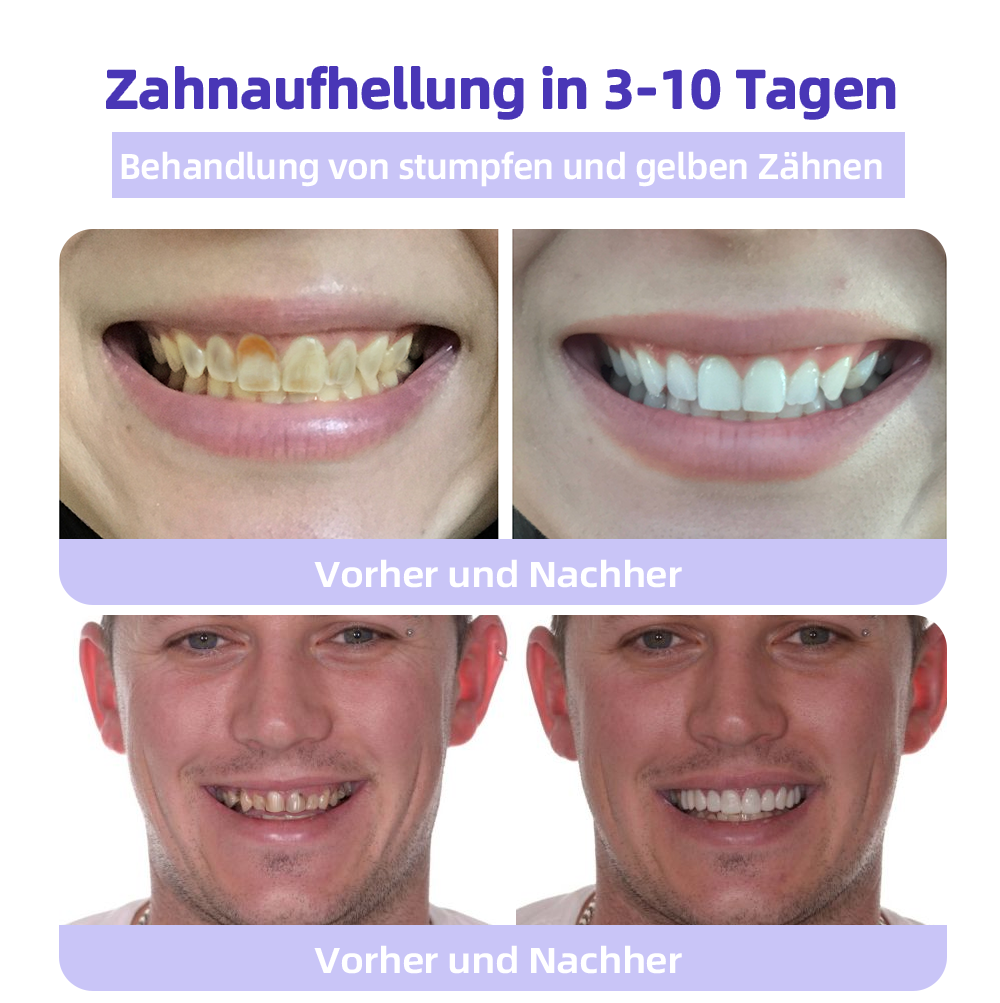 (Ihre Zähne – Unsere Expertise) ODEIUN™ Zahnreparatur-Mineralpuder (Empfohlen von der EDA)