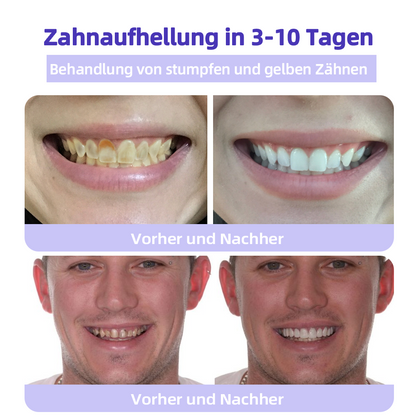 (Ihre Zähne – Unsere Expertise) ODEIUN™ Zahnreparatur-Mineralpuder (Empfohlen von der EDA)
